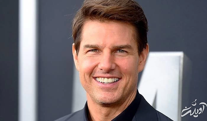 لمینت دندان